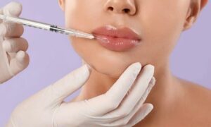 Kdo má opravnění na botox v ČR? Důležité informace pro vaši bezpečnost